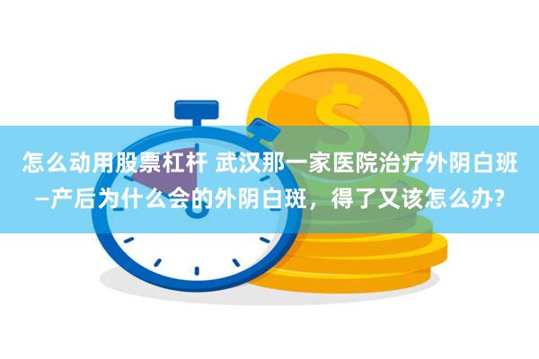 怎么动用股票杠杆 武汉那一家医院治疗外阴白班—产后为什么会的外阴白斑，得了又该怎么办?